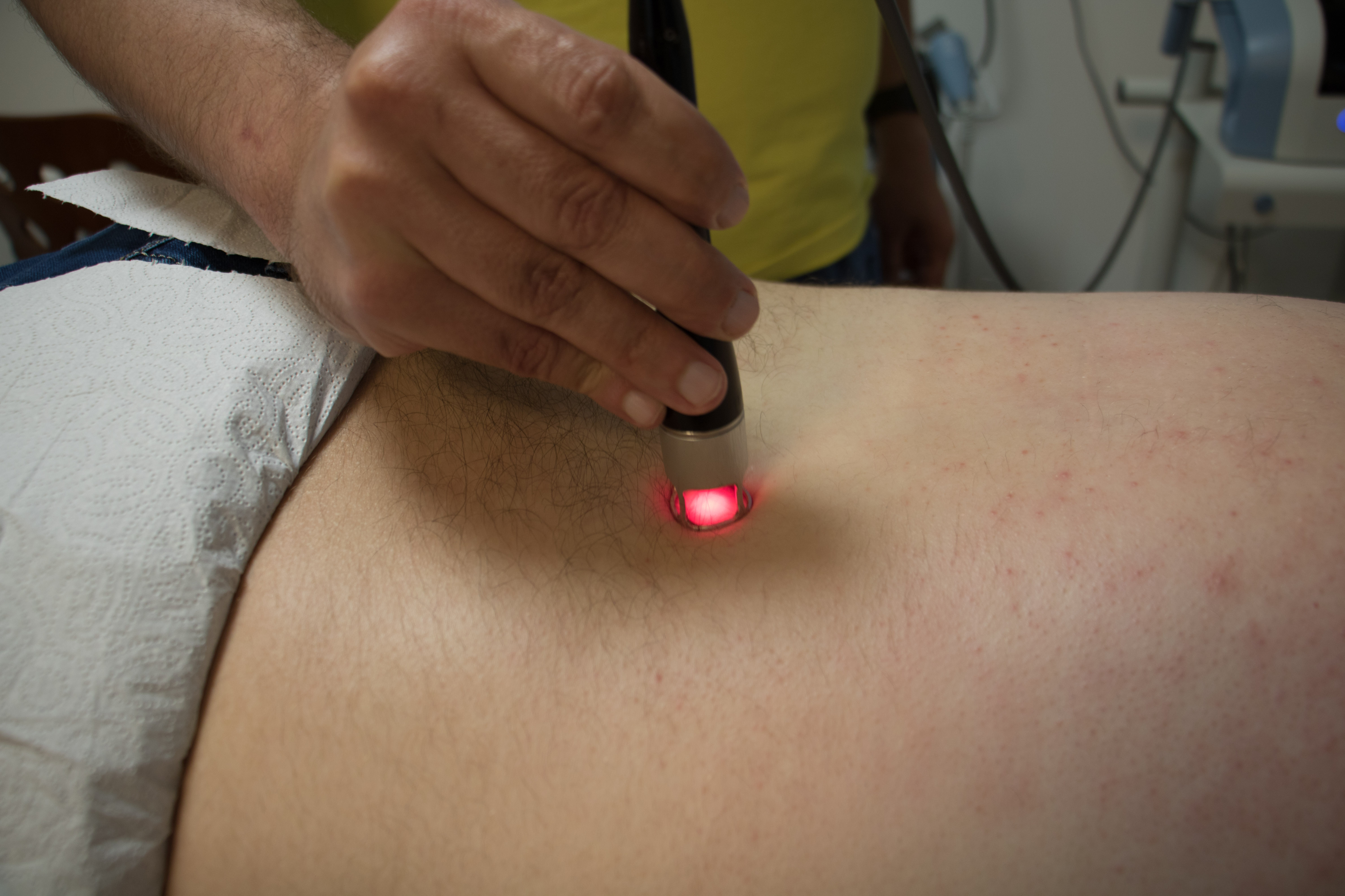 Laser wysokoenergetyczny